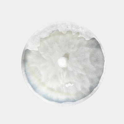 Damping-off Pythium aphanidermatum in petri dish